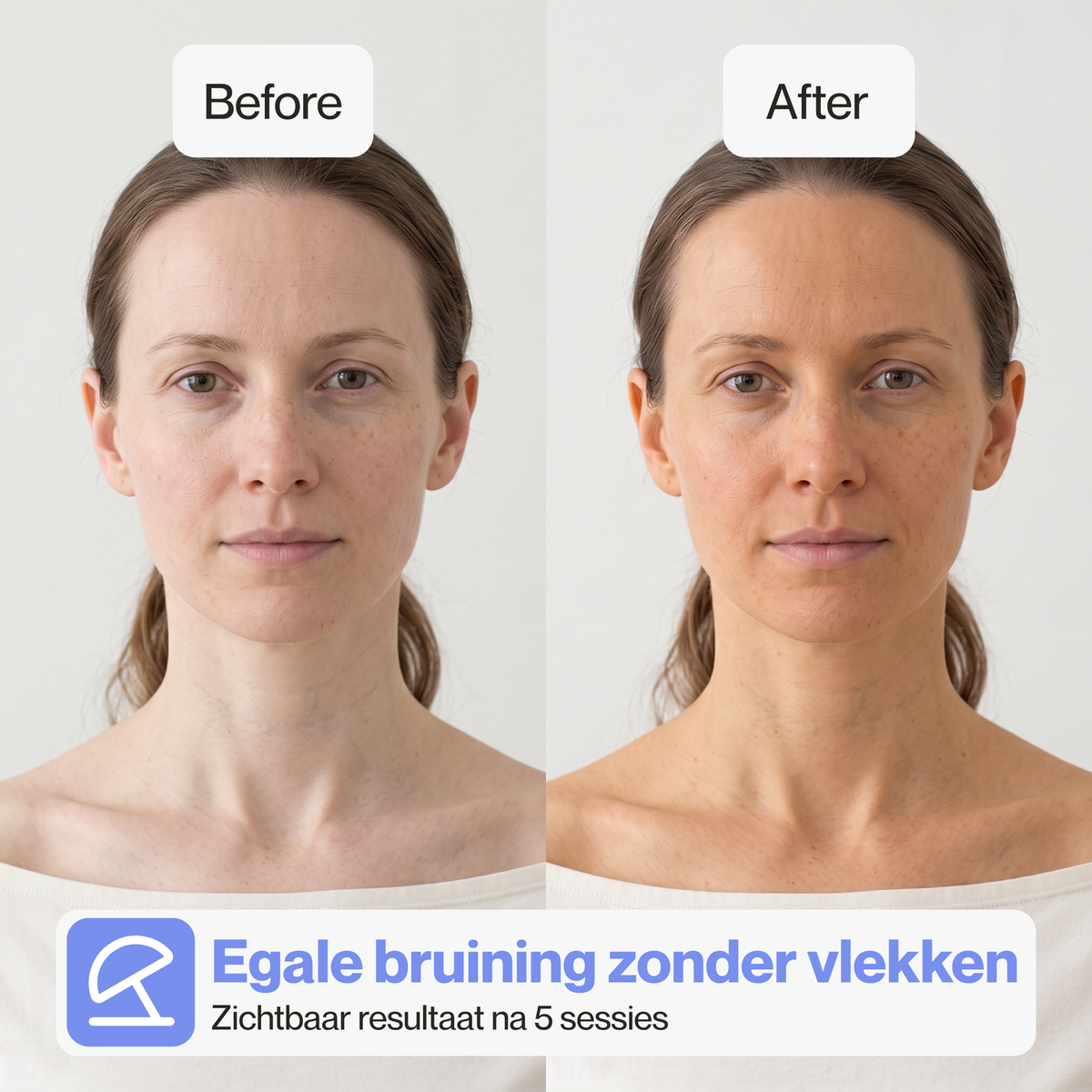Zichtbaar resultaat van de gezichtsbruiner na vijf sessies